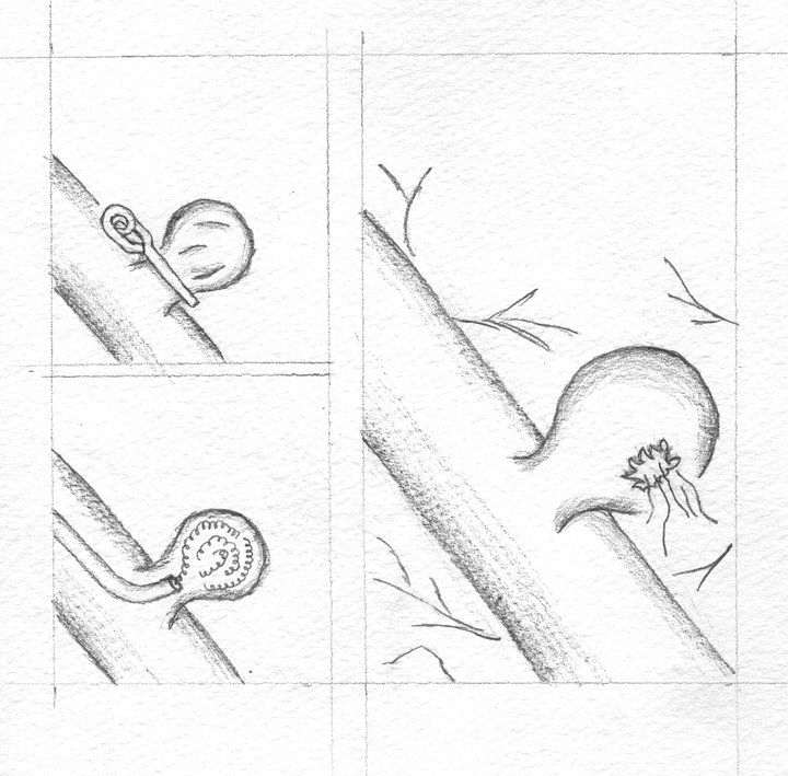 Pencil drawing showing steps to surgically correct an aneurysm.